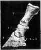 THE BONES OF THE PHALANX