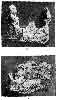 SHOWING CHANGES IN THE OS PEDIS WITH LAMINITIS OF LONG STANDING,