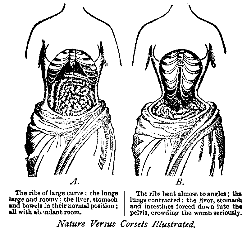 Nature Versus Corsets Illustrated.