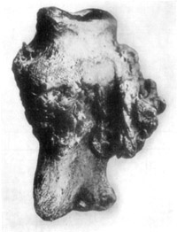 Fig. 19—Phalangeal exostoses in chronic ringbone. Museum specimen of the Kansas City Veterinary College.