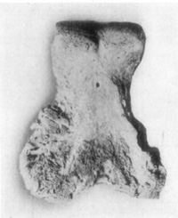 Fig. 30—Rarefying osteitis wherein articular cartilage was destroyed in a case of arthritis of fetlock joint.