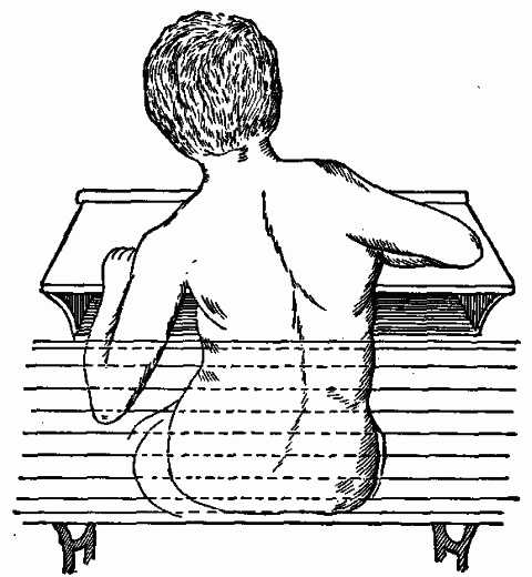 Fig. 105—Effect on spinal column of improper position in writing. (From Pyle's Personal Hygiene.) Fig. 105