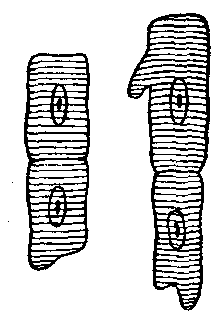 Fig. 112—Muscle cells from the heart, highly magnified (after Schäfer). Fig. 112