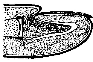 Fig. 123—Section of end of finger showing nail in position. Fig. 123
