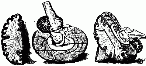 Fig. 137—Model for demonstrating the brain (dissectible). Fig. 137