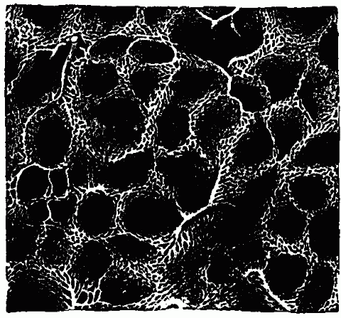Fig. 37—Inner lung surface (magnified), the blood vessels injected with coloring matter. The small pits are alveoli, and the vessels in their walls are chiefly capillaries. Fig. 37