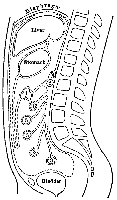 Fig. 64—Diagram of the peritoneum. 1. Transverse colon. 2. Duodenum. 3. Small intestine. 4. Pancreas. Fig. 64
