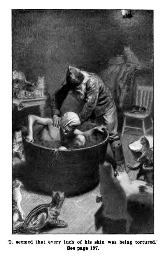 Every Inch of his Skin Was Being Tortured 197-224