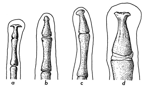 Fig. 4. Terminal phalanges of four leptodactylid frogs (all × 13.5). (a) Eleutherodactylus mexicanus, KU 55593; (b) Eupsophus roseus, KU 84731; (c) Eupsophus quixensis, UIMNH 59643; and (d) Hylactophryne augusti, KU 56192.