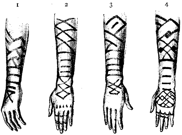 TATTOO MARKS