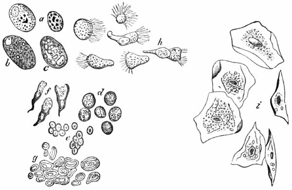 Sputum from a case of asthma