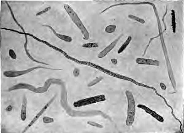 Hyaline and granular casts, mucous threads, and cylindroids