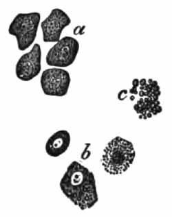 Renal epithelium from nephritic urine