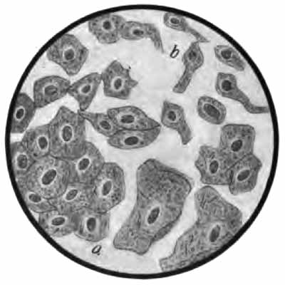 Epithelial cells from urethra and bladder