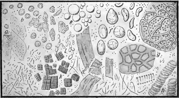 General view of the gastric contents