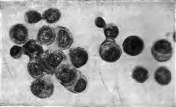 Cytodiagnosis