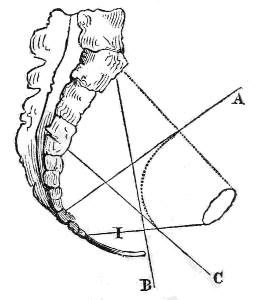 Passage of the Pelvis