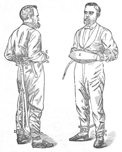 drawing of a man with hands and ankles restrained, front and back view