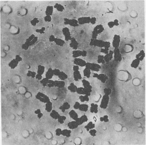 Cell after treatment with salt solution