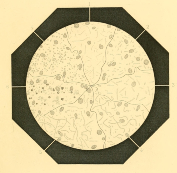 Plate 1. Principal Disease-ferments met with in Wort and Beer.