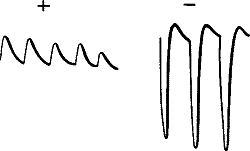 Fig.&nbsp;27.&mdash;Abnormal Positive Responses in Stale Leaf-stalk of Turnip converted into Normal Negative under Strong Stimulation