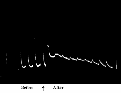 Fig.&nbsp;49.&mdash;Nearly Complete Abolition of Response by Strong KOH