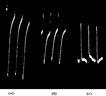 Fig.&nbsp;67.&mdash;Negative, Diphasic, and Positive Resultant Response
