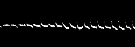 Fig.&nbsp;78.&mdash;The Gradual Transition from Abnormal To Normal Response in Platinum