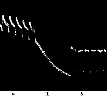 Fig.&nbsp;79.&mdash;The Normal Response a in Nerve Enhanced to b after Continuous Stimulation T (Waller)