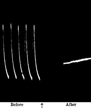 Fig.&nbsp;92.&mdash;Abolition of Response by Oxalic Acid