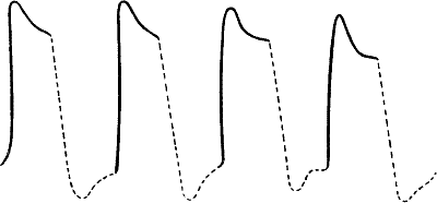 Fig.&nbsp;105.&mdash;After-oscillation