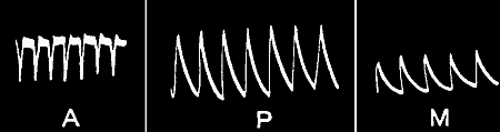 Fig.&nbsp;112.&mdash;Uniform Responses in (A) Nerve, (P) Plant, and (M) Metal