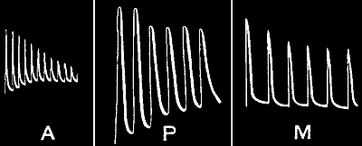 Fig.&nbsp;113.&mdash;Fatigue (A) in Muscle, (P) in Plant, (M) in Metal