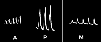 Fig.&nbsp;114.&mdash;&lsquo;Staircase&rsquo; in Muscle, Plant, and Metal