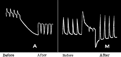 Fig.&nbsp;115.&mdash;Increased Response after Continuous Stimulation in Nerve and Metal