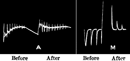 Fig.&nbsp;116.&mdash;Modified Abnormal Response in (A) Nerve and (M) Metal converted into Normal, after Continuous Stimulation
