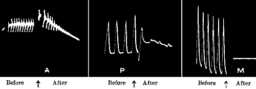 Fig.&nbsp;117.&mdash;Abolition of Response in Nerve, Plant, and Metal by the Action of the same &lsquo;Poison&rsquo;