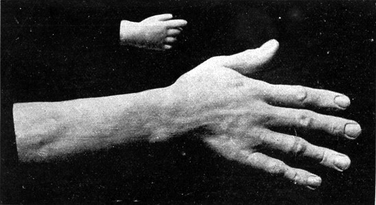 THE HANDS OF "TOM THUMB" AND LOUSHKIN, THE RUSSIAN
GIANT.