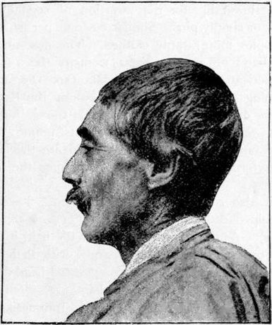 &ldquo;Toulousaine&rdquo; Deformation