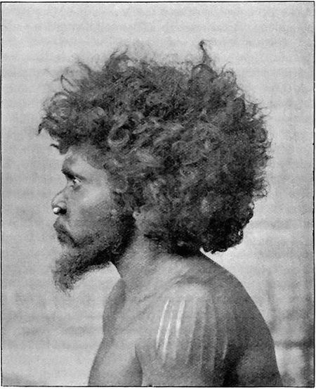 &ldquo;Billy,&rdquo; Profile View