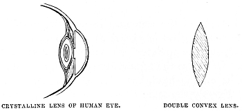 Image unavailable: CRYSTALLINE LENS OF HUMAN EYE.
DOUBLE CONVEX LENS.