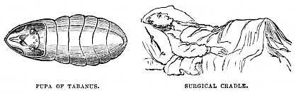 Image unavailable: PUPA OF TABANUS.
SURGICAL CRADLE.