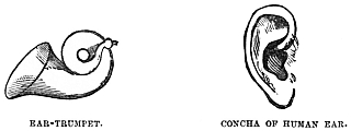 Image unavailable: EAR-TRUMPET.
CONCHA OF HUMAN EAR.